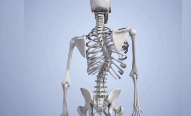 bad posture skeleton